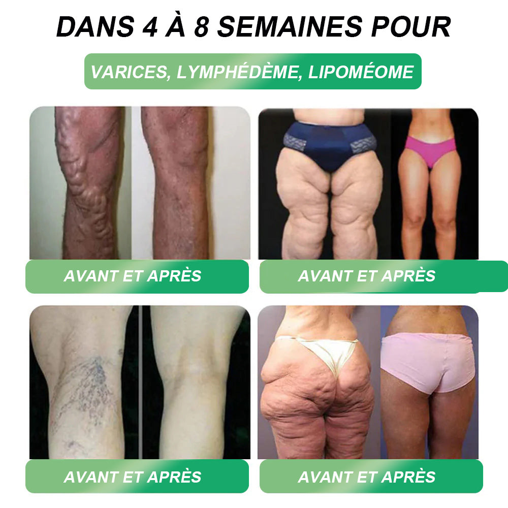 DOCTІA® G 𝐿 P-1 𝑺𝒐𝒍𝒖𝒕𝒊𝒐𝒏 Orale📊 Premiers résultats visibles en 7 jours 💧Pour l'obésité, le cœur et la circulation, le diabète, l'apnée du sommeil, les articulations et plus encore